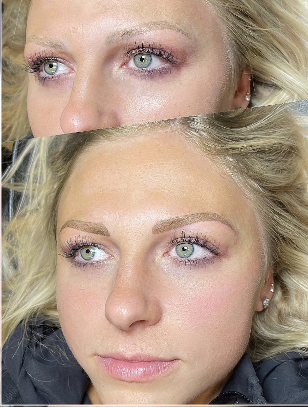 Brow transformation before and after