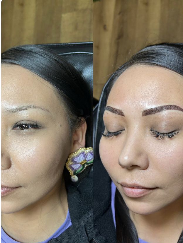 Brow before and after