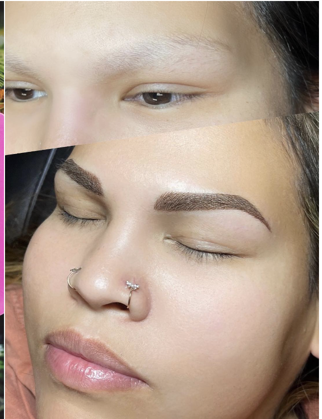 Permanent brow result